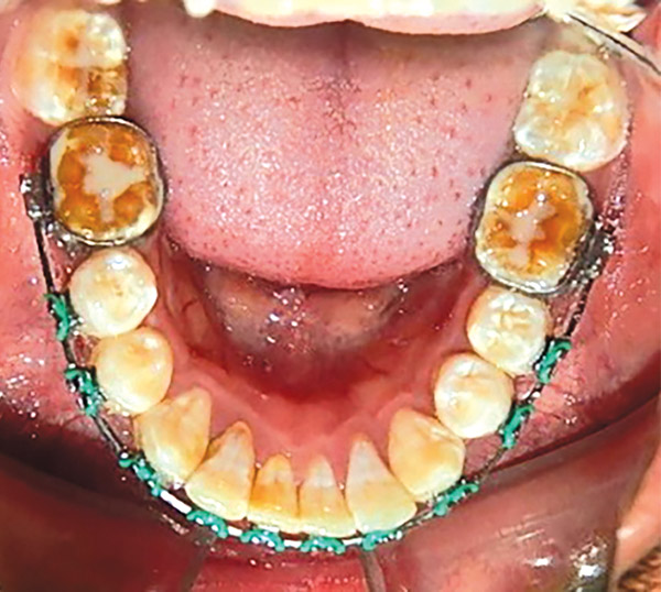 Figura 16. Inferior. 