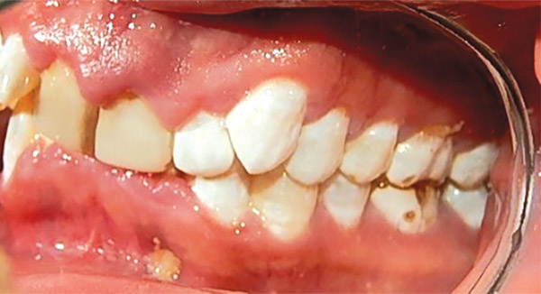 Figura 4. Izquierda. 