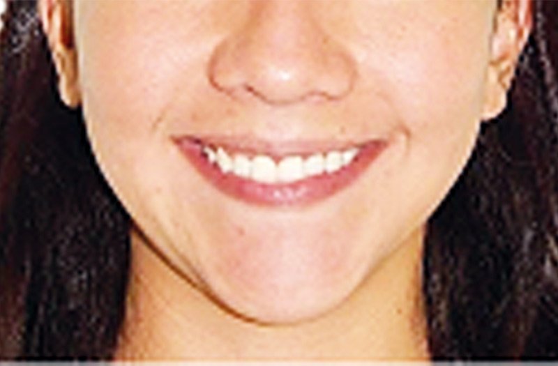 Figura 10.