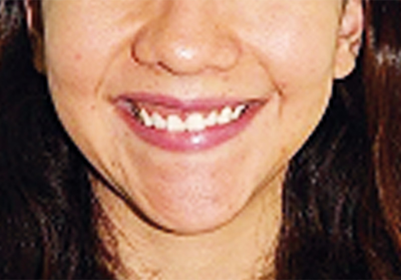 Figura 14.
