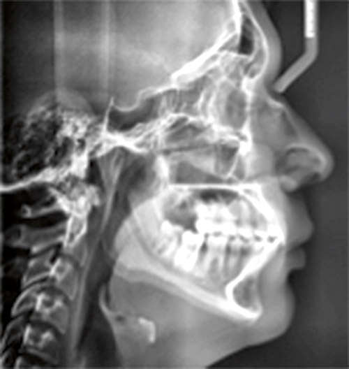 Figura 14. Rx lateral de cráneo.