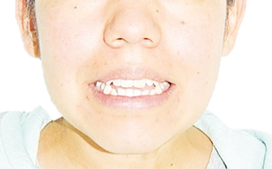 Figura 3. Sonrisa de inicio.