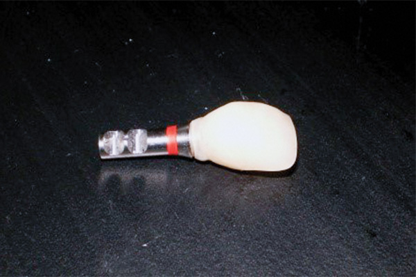 Figura 14. Provisional correctamente adaptado a la plataforma de un implante análogo. 