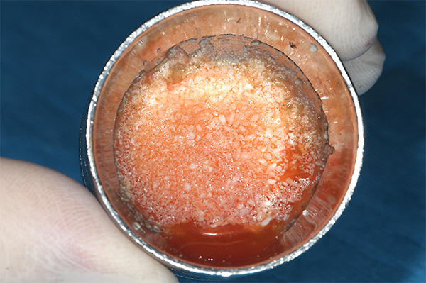 Figura 15. El plasma humedece y rehidrata las partículas de aloinjerto y se deja reposar durante 10-12 minutos antes de su uso. 