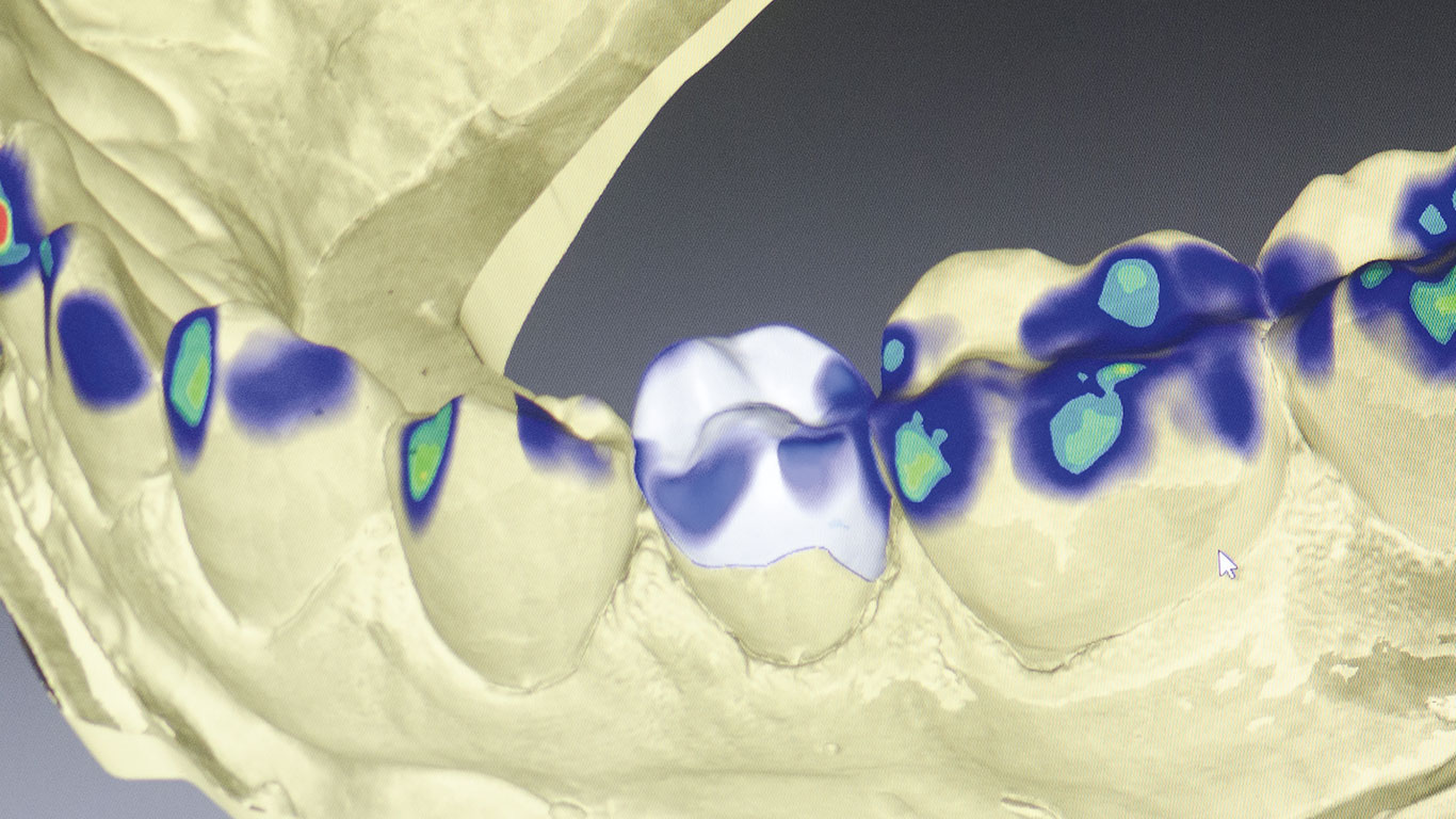 La tecnología tridimensional como auxiliar para el diagnóstico en ortodoncia 