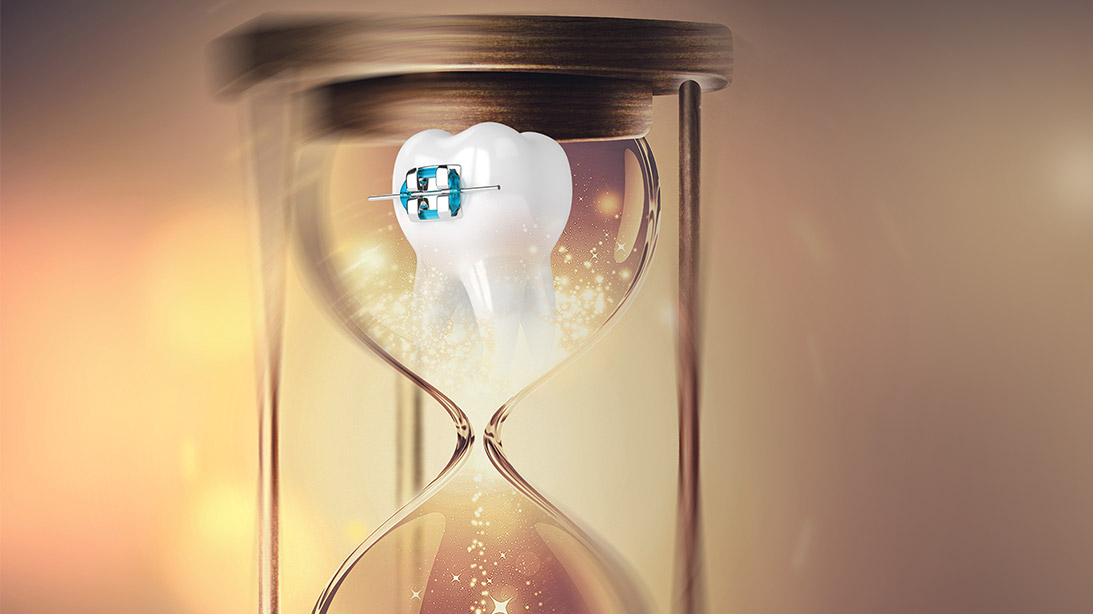 Tratamiento ortodóncico en paciente clase II con fluorosis dental