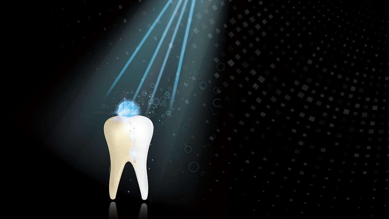 Evaluación de la rugosidad del esmalte dental posterior a la remoción de resina residual sucesivo al tratamiento de ortodoncia mediante el uso de 2 sistemas diferentes. Parte 1 