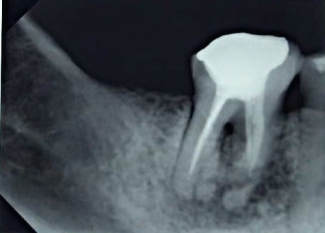 Figura 1. Radiografía Inicial.