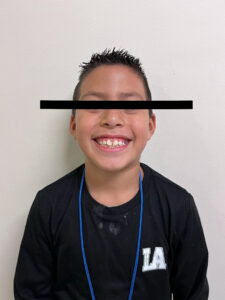 Figura 1. Fotografía de frente.